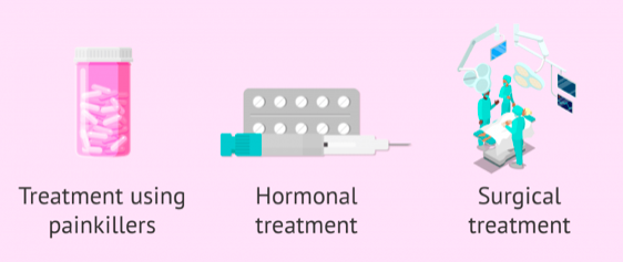 Endometriosis Treatment Options